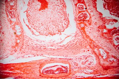 Paralel kolajen liflerini, fibroblastları ve kan damarlarını gösteren yoğun bağ dokusunun mikroskobik görüntüsü, yapısal ve hücresel detayları göstermek için kırmızıya boyanmış..