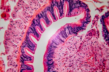 Lekelenmiş biyolojik doku örneğinin mikroskobik yakın çekimi canlı pembe ve mor renkli hücre yapılarını gösteriyor. Muhtemelen epitel veya bağırsak dokusu..