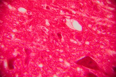 Lekelenmiş insan kas dokusunun fibröz yapısını ve hücresel bileşenleri gösteren mikroskobik görüntüsü. Yüksek büyütülmüş resim.