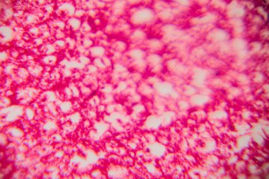 Mikroskobik görüntü insan adipoz dokusu net lipit boşlukları ve pembe lekeli bir matris ile kümelenmiş hücreleri gösteriyor..