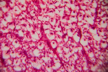 Mikroskobik görüntü insan adipoz dokusu net lipit boşlukları ve pembe lekeli bir matris ile kümelenmiş hücreleri gösteriyor..