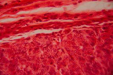 Kalp kası dokusunun mikroskobik görüntüsü çizgili lifler, birbirine bağlı diskler ve kırmızı ve pembe tonlarda lekelenmiş dallanma desenleri gösteriyor..