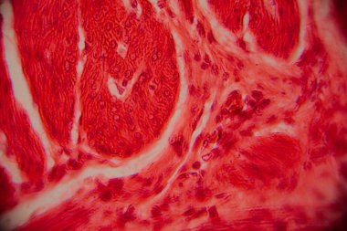Kalp kası dokusunun mikroskobik görüntüsü çizgili lifler, birbirine bağlı diskler ve kırmızı ve pembe tonlarda lekelenmiş dallanma desenleri gösteriyor..