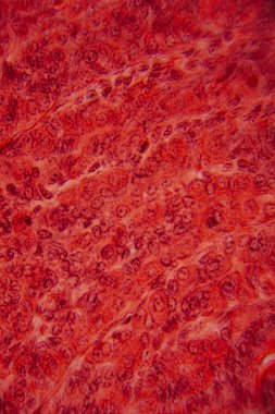 Kalp kası dokusunun mikroskobik görüntüsü çizgili lifler, birbirine bağlı diskler ve kırmızı ve pembe tonlarda lekelenmiş dallanma desenleri gösteriyor..