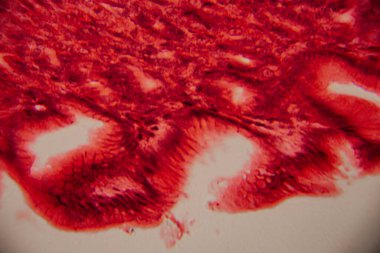 Kalp kası dokusunun mikroskobik görüntüsü çizgili lifler, birbirine bağlı diskler ve kırmızı ve pembe tonlarda lekelenmiş dallanma desenleri gösteriyor..