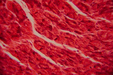 Kalp kası dokusunun mikroskobik görüntüsü çizgili lifler, birbirine bağlı diskler ve kırmızı ve pembe tonlarda lekelenmiş dallanma desenleri gösteriyor..