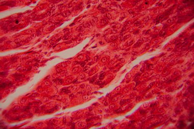 Kalp kası dokusunun mikroskobik görüntüsü çizgili lifler, birbirine bağlı diskler ve kırmızı ve pembe tonlarda lekelenmiş dallanma desenleri gösteriyor..
