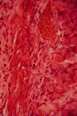 Kalp kası dokusunun mikroskobik görüntüsü çizgili lifler, birbirine bağlı diskler ve kırmızı ve pembe tonlarda lekelenmiş dallanma desenleri gösteriyor..