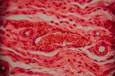 Kalp kası dokusunun mikroskobik görüntüsü çizgili lifler, birbirine bağlı diskler ve kırmızı ve pembe tonlarda lekelenmiş dallanma desenleri gösteriyor..