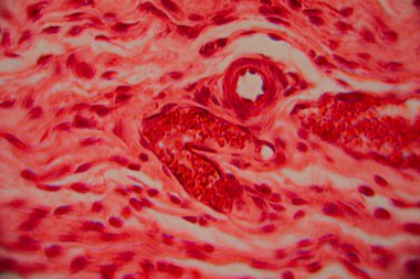 Kalp kası dokusunun mikroskobik görüntüsü çizgili lifler, birbirine bağlı diskler ve kırmızı ve pembe tonlarda lekelenmiş dallanma desenleri gösteriyor..