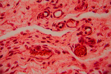 Kalp kası dokusunun mikroskobik görüntüsü çizgili lifler, birbirine bağlı diskler ve kırmızı ve pembe tonlarda lekelenmiş dallanma desenleri gösteriyor..