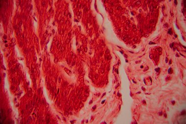 Kalp kası dokusunun mikroskobik görüntüsü çizgili lifler, birbirine bağlı diskler ve kırmızı ve pembe tonlarda lekelenmiş dallanma desenleri gösteriyor..