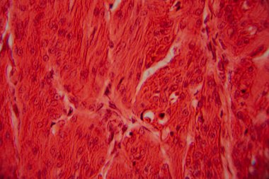 Kalp kası dokusunun mikroskobik görüntüsü çizgili lifler, birbirine bağlı diskler ve kırmızı ve pembe tonlarda lekelenmiş dallanma desenleri gösteriyor..