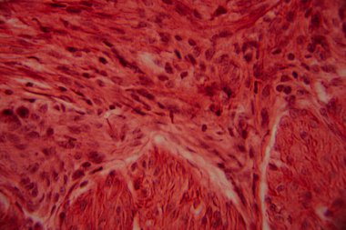 Kalp kası dokusunun mikroskobik görüntüsü çizgili lifler, birbirine bağlı diskler ve kırmızı ve pembe tonlarda lekelenmiş dallanma desenleri gösteriyor..