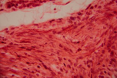 Kalp kası dokusunun mikroskobik görüntüsü çizgili lifler, birbirine bağlı diskler ve kırmızı ve pembe tonlarda lekelenmiş dallanma desenleri gösteriyor..