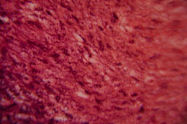 Mikroskobik görüntü, balık solungaç dokusunun gözle görülür hücre katmanları ve solungaç lamellae yapısını gösteren detaylı lekeli bir kesit gösteriyor..