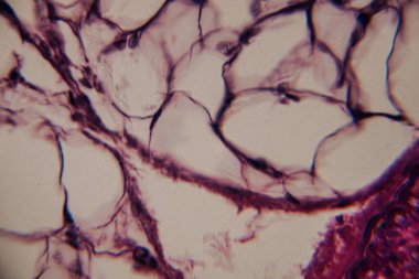 Adipoz dokusunun mikroskobik yakın plan görüntüsü görünür çekirdekli ve lekeli hücre zarları olan büyük yağ hücrelerini gösteriyor. Belirgin, koyu lekeli bağ dokusu yapıları.
