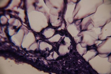 Adipoz dokusunun mikroskobik yakın plan görüntüsü görünür çekirdekli ve lekeli hücre zarları olan büyük yağ hücrelerini gösteriyor. Belirgin, koyu lekeli bağ dokusu yapıları.