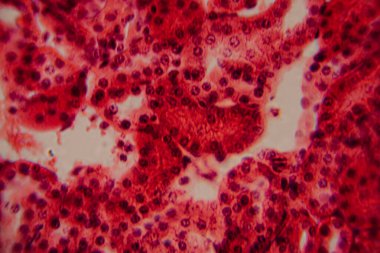 Yüksek derecede büyütülmüş karaciğer dokusunun parlak kırmızı tonlarda görünen hepatositleri ve hücre yapısını gösteren görüntüsü..