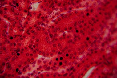 Yüksek derecede büyütülmüş karaciğer dokusunun parlak kırmızı tonlarda görünen hepatositleri ve hücre yapısını gösteren görüntüsü..