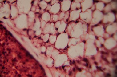 Adipoz doku hücrelerinin mikroskobik görüntüsü pembe lekeli histoloji bölümünde büyük lipit damlacıklar ve hücre zarları gösteriyor..