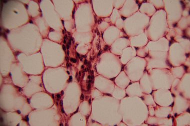 Adipoz doku hücrelerinin mikroskobik görüntüsü pembe lekeli histoloji bölümünde büyük lipit damlacıklar ve hücre zarları gösteriyor..