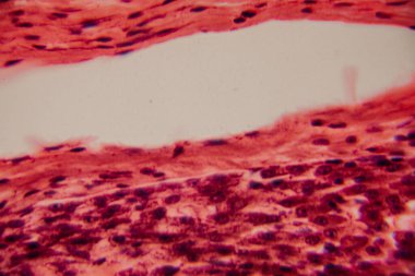 Yüksek derecede büyütülmüş karaciğer dokusunun parlak kırmızı tonlarda görünen hepatositleri ve hücre yapısını gösteren görüntüsü..