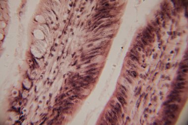 Mikroskobik görüntü insan bağırsak villinin epitel hücreleri, çekirdekleri ve bardaktaki hücrelerle kesitini gösteriyor..