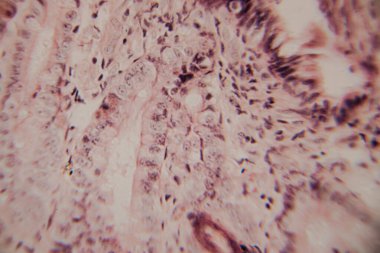 Mikroskobik görüntü insan bağırsak villinin epitel hücreleri, çekirdekleri ve bardaktaki hücrelerle kesitini gösteriyor..