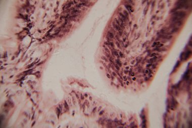 Mikroskobik görüntü insan bağırsak villinin epitel hücreleri, çekirdekleri ve bardaktaki hücrelerle kesitini gösteriyor..