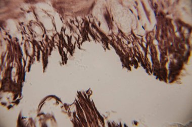 Genişletilmiş villi ve açık arkaplanda lekeli epitel yapıları olan insan bağırsak mukozasının mikroskobik yakın plan görüntüsü..