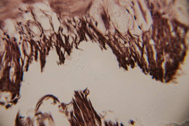 Genişletilmiş villi ve açık arkaplanda lekeli epitel yapıları olan insan bağırsak mukozasının mikroskobik yakın plan görüntüsü..