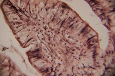 Mikroskobik görüntü insan bağırsak villinin epitel hücreleri, çekirdekleri ve bardaktaki hücrelerle kesitini gösteriyor..