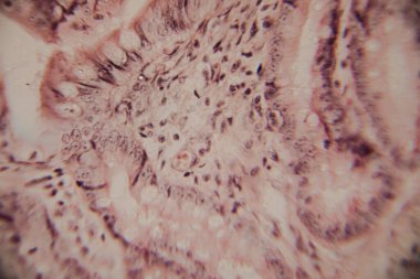 Mikroskobik görüntü insan bağırsak villinin epitel hücreleri, çekirdekleri ve bardaktaki hücrelerle kesitini gösteriyor..