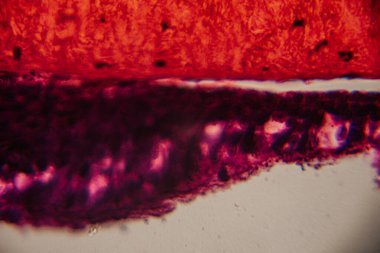 Tarihsel görüntü koyu kırmızı ve mor tonlarda lekelenmiş yoğun bağ dokusunun altında katmanlanmış epitel hücreler gösteriyor..