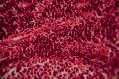 Pembe lekeli bir matris içinde yoğun paketlenmiş, koyu lekeli lenfositleri gösteren lenfoid dokusunun büyütülmüş görüntüsü..