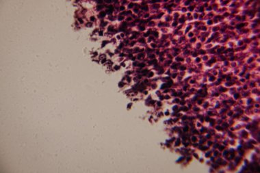 Pembe lekeli bir matris içinde yoğun paketlenmiş, koyu lekeli lenfositleri gösteren lenfoid dokusunun büyütülmüş görüntüsü..