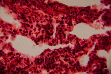 Tarihsel görüntü kemik iliği dokusunu kırmızı lekeli hematopoetik hücreler ve yüksek büyütmede görünen beyaz yağ bölgeleriyle gösteriyor..