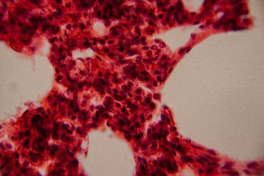 Tarihsel görüntü kemik iliği dokusunu kırmızı lekeli hematopoetik hücreler ve yüksek büyütmede görünen beyaz yağ bölgeleriyle gösteriyor..