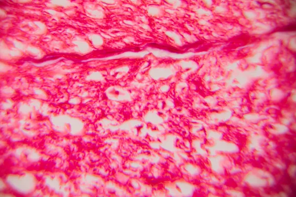 Kalp kası dokusunun mikroskobik görüntüsü çizgili lifler, birbirine bağlı diskler ve kırmızı ve pembe tonlarda lekelenmiş dallanma desenleri gösteriyor..