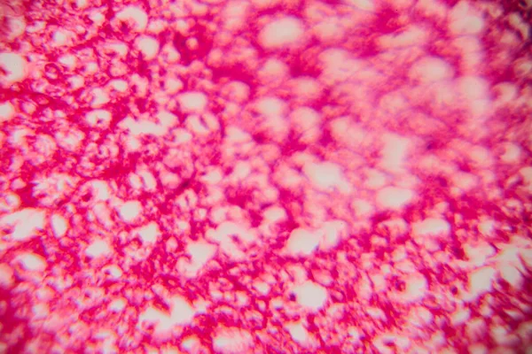 Mikroskobik görüntü insan adipoz dokusu net lipit boşlukları ve pembe lekeli bir matris ile kümelenmiş hücreleri gösteriyor..