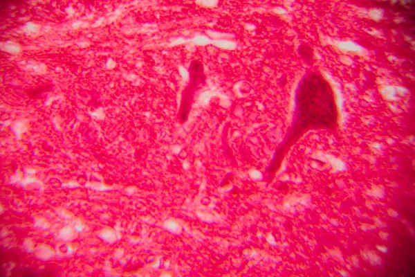 Lekelenmiş insan kas dokusunun fibröz yapısını ve hücresel bileşenleri gösteren mikroskobik görüntüsü. Yüksek büyütülmüş resim.