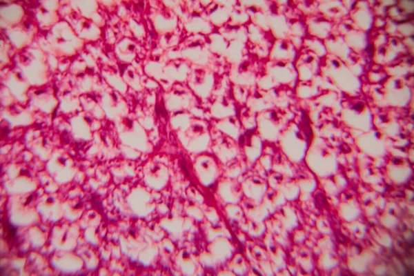 Mikroskobik görüntü insan adipoz dokusu net lipit boşlukları ve pembe lekeli bir matris ile kümelenmiş hücreleri gösteriyor..