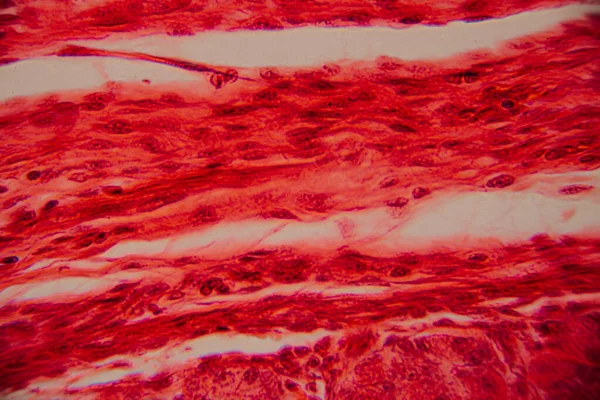Kalp kası dokusunun mikroskobik görüntüsü çizgili lifler, birbirine bağlı diskler ve kırmızı ve pembe tonlarda lekelenmiş dallanma desenleri gösteriyor..