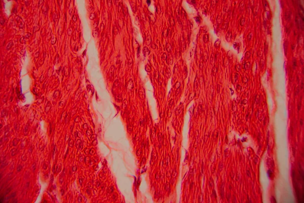 Kalp kası dokusunun mikroskobik görüntüsü çizgili lifler, birbirine bağlı diskler ve kırmızı ve pembe tonlarda lekelenmiş dallanma desenleri gösteriyor..