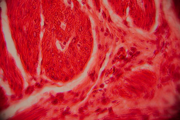 Kalp kası dokusunun mikroskobik görüntüsü çizgili lifler, birbirine bağlı diskler ve kırmızı ve pembe tonlarda lekelenmiş dallanma desenleri gösteriyor..