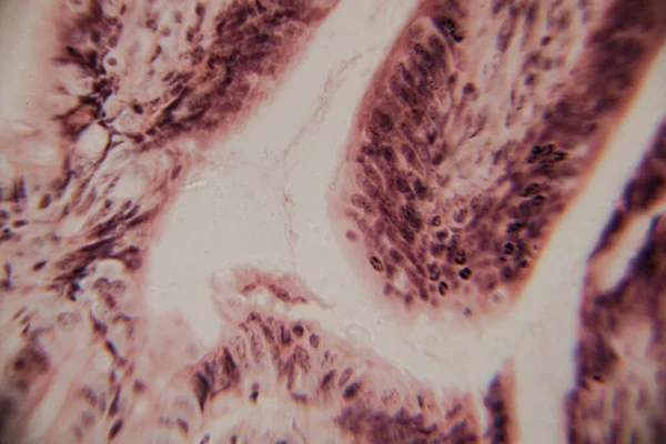 Mikroskobik görüntü insan bağırsak villinin epitel hücreleri, çekirdekleri ve bardaktaki hücrelerle kesitini gösteriyor..