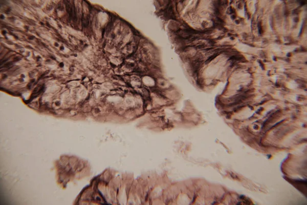 Mikroskobik görüntü insan bağırsak villinin epitel hücreleri, çekirdekleri ve bardaktaki hücrelerle kesitini gösteriyor..