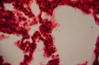 Tarihsel görüntü kemik iliği dokusunu kırmızı lekeli hematopoetik hücreler ve yüksek büyütmede görünen beyaz yağ bölgeleriyle gösteriyor..