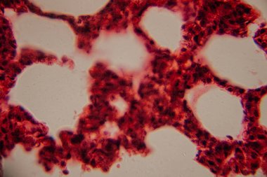 Tarihsel görüntü kemik iliği dokusunu kırmızı lekeli hematopoetik hücreler ve yüksek büyütmede görünen beyaz yağ bölgeleriyle gösteriyor..